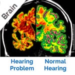 Scan of Brain with Hearing Problems